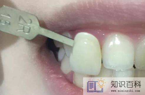 拍片有智齿一定会长吗3