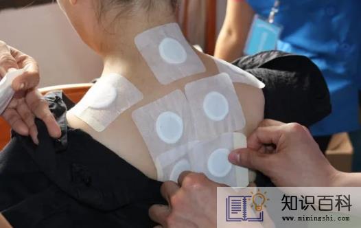 2022年三伏贴什么时候贴2