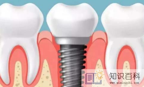 牙齿根部掉了一小块有凹洞能修复吗2