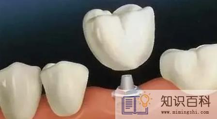 牙结石掉了牙龈空了牙齿会不会掉3
